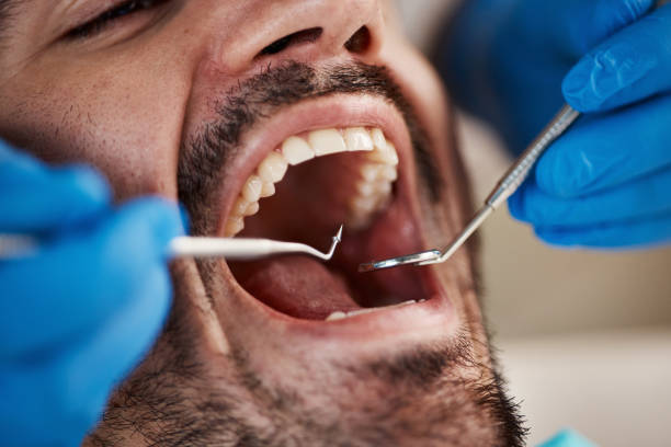 Best Cracked Tooth Emergency Dentist  in Huxley, IA